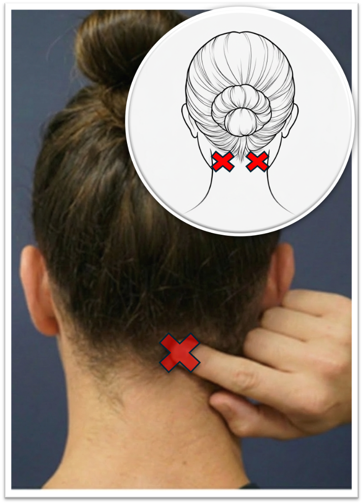 Occipital trigger point