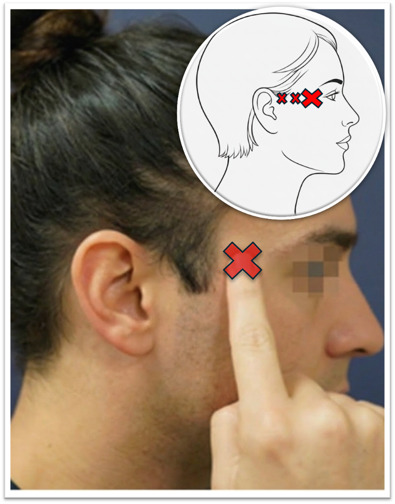 Temporal trigger point